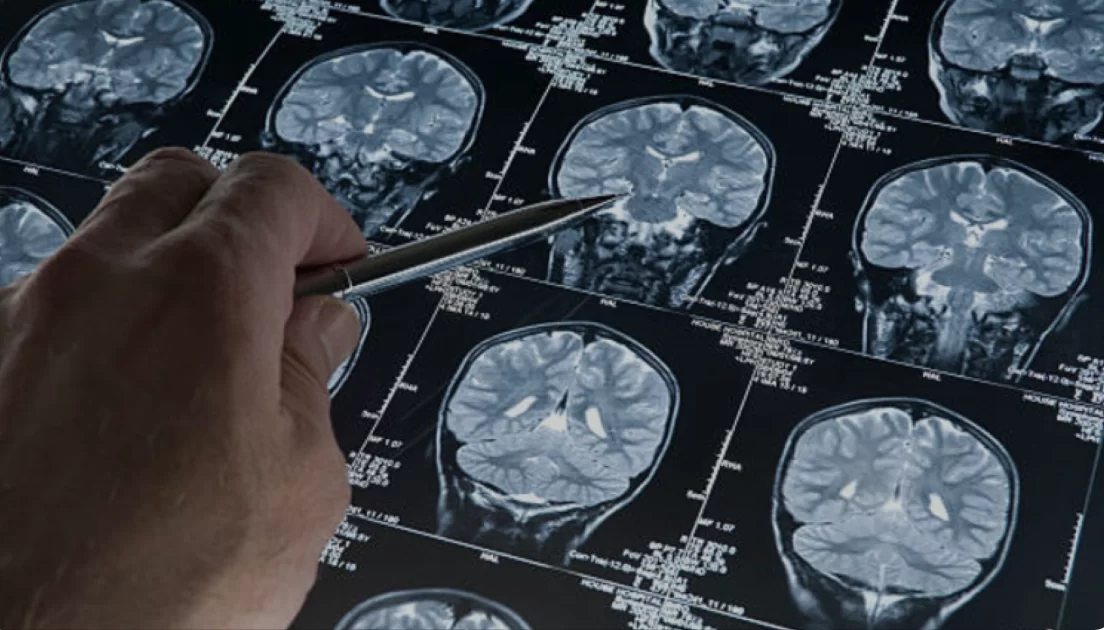Nuove Frontiere della Comprensione del Cervello